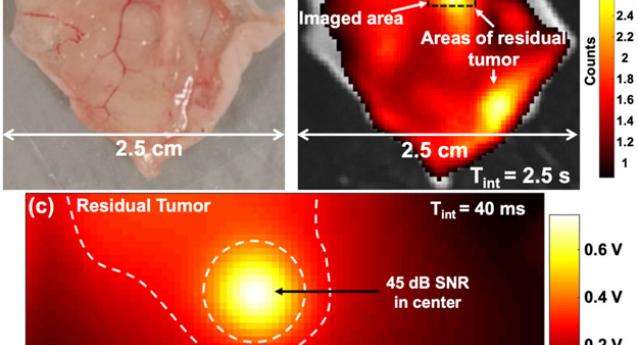 Imaging allows for identification of residual tumour tissue which is not visible to the naked eye.
