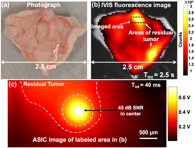 ASG Tumor Imaging